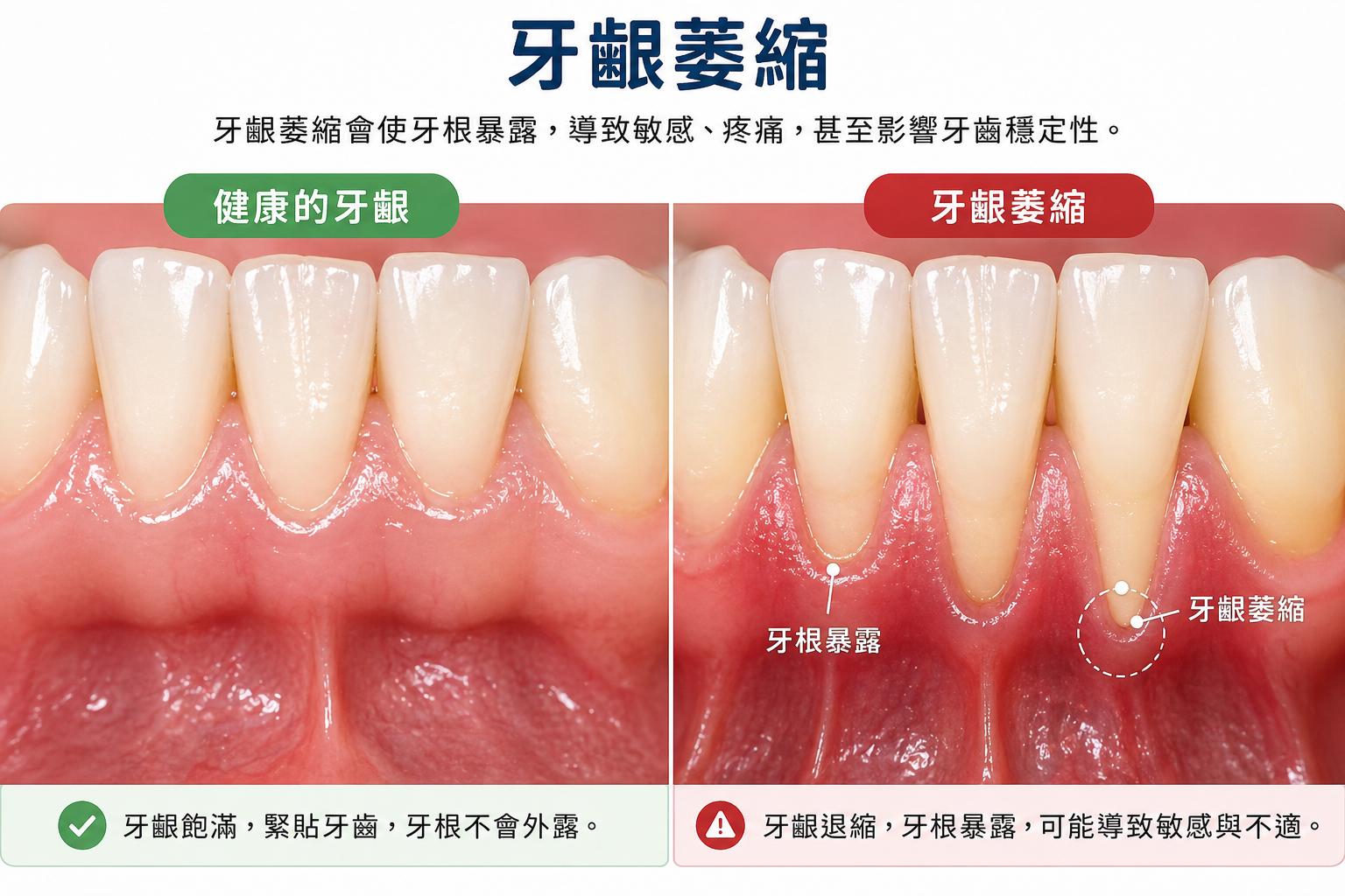 濕疹症狀